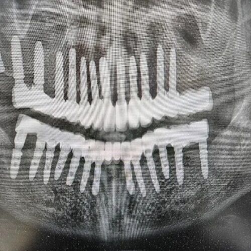 Prime Smile Dental, PC photo 5